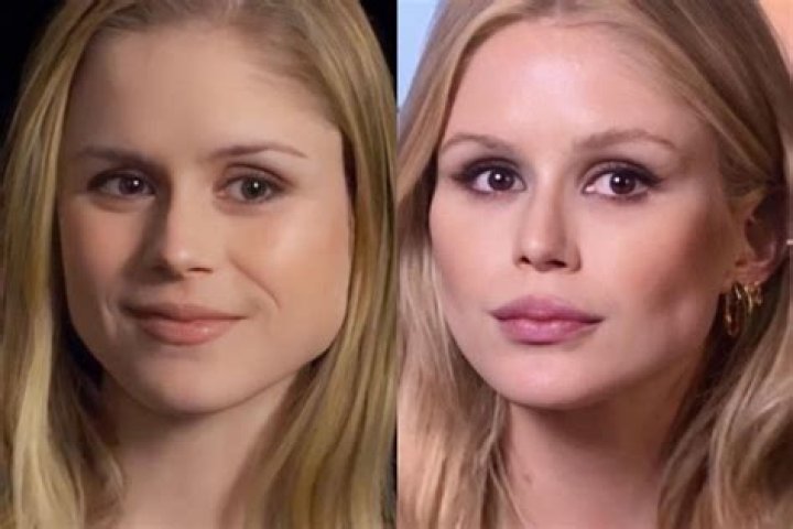 Dana Perino Before Plastic Surgery: The Untold Journey of Transformation