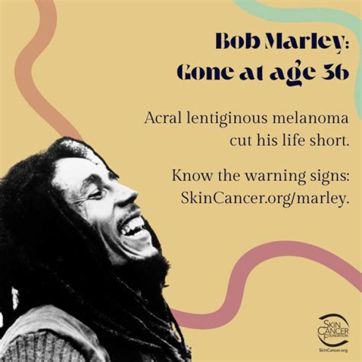 Why Did Bob Marley Refuse Treatment for Cancer: Unveiling the Truth Behind His Decision